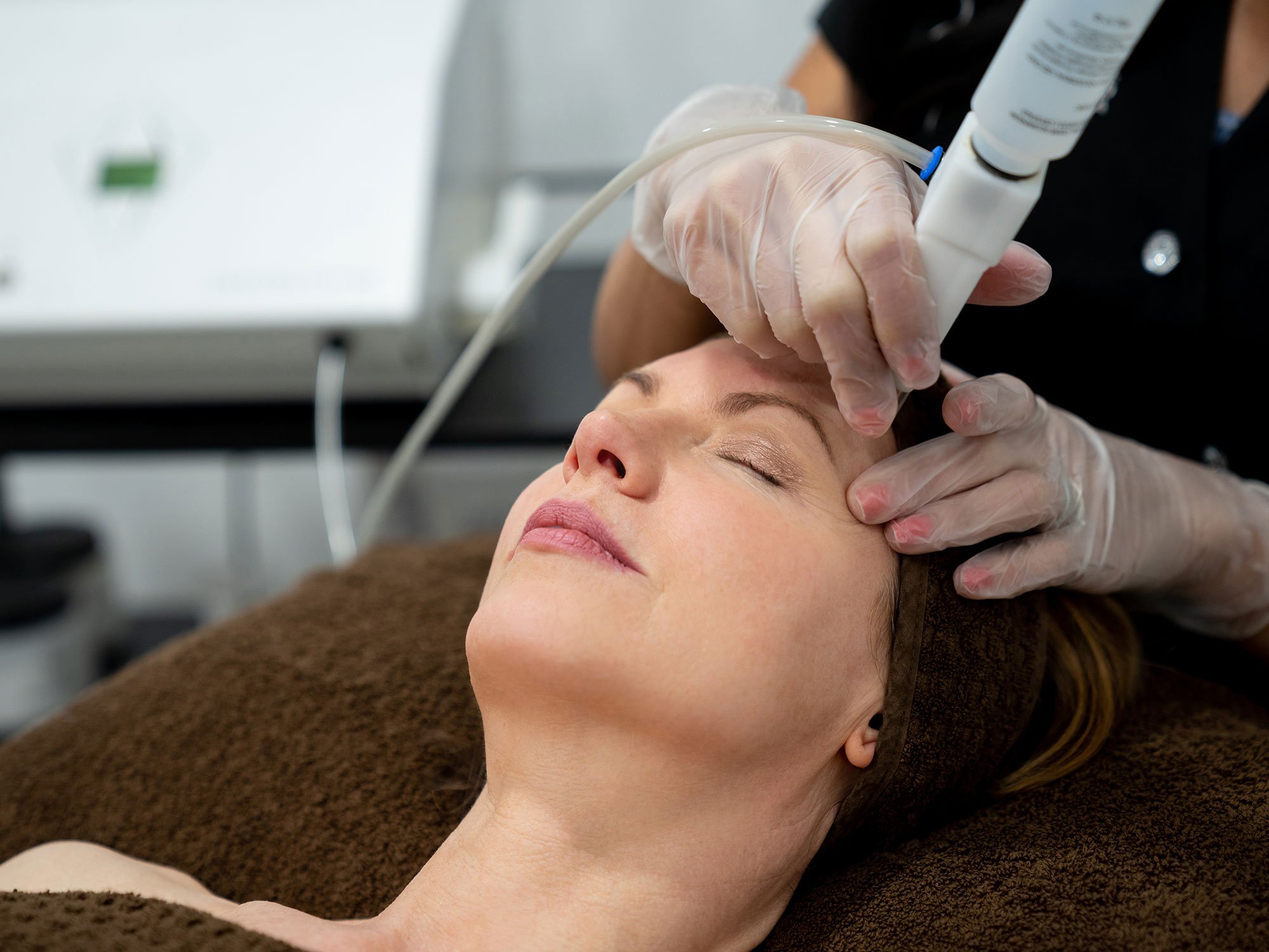 Laser Treatments Dedham